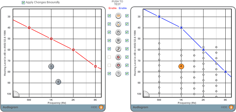 Indicators HL Audiogram Graph