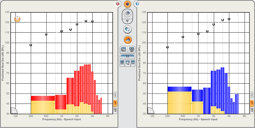 Speech Mapping input gain view Speech Mapping input gain view