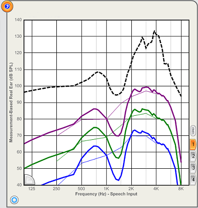 Measurement-Based Real Ear Response (dB SPL)
